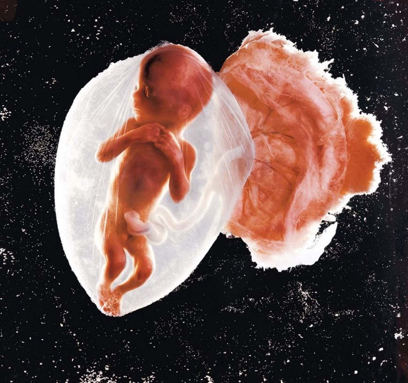 Fetus, 18 weeks, Lennart Nilsson, 1965