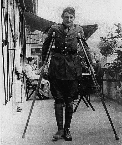 Ernest Hemingway injury WW1